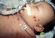 Иммунолог: дети в Украине умирают от менингококкового сепсиса