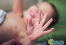 На Украине могут объявить эпидемию кори