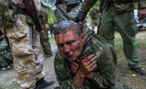 Обе стороны конфликта в Донбассе причастны к пыткам - Human Rights Watch