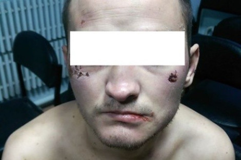 Пытки и издевательства в украинских тюрьмах